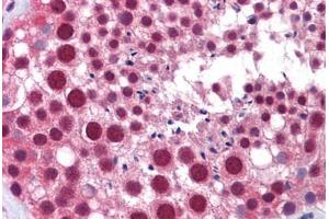 Human Testis: Formalin-Fixed, Paraffin-Embedded (FFPE) (MED17 anticorps  (AA 551-652))