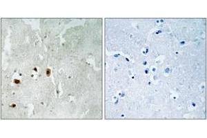 Immunohistochemistry analysis of paraffin-embedded human brain, using Tip60 (Phospho-Ser90) Antibody. (KAT5 anticorps  (pSer90))