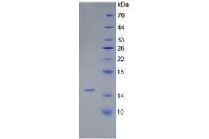 SDS-PAGE of Protein Standard from the Kit (Highly purified E. (BMP4 Kit CLIA)