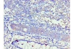 Immunohistochemistry of paraffin-embedded human colon tissue using ABIN7156944 at dilution of 1:100