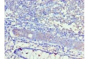 Immunohistochemistry of paraffin-embedded human colon tissue using ABIN7156944 at dilution of 1:100 (KCNN4 anticorps  (AA 288-427))
