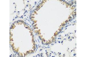 Immunohistochemistry of paraffin-embedded Mouse lung using FLT4 Polyclonal Antibody at dilution of 1:200 (40x lens). (FLT4 anticorps)