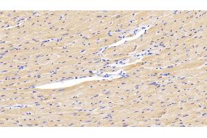 Detection of LOXL1 in Mouse Cardiac Muscle Tissue using Polyclonal Antibody to Lysyl Oxidase Like Protein 1 (LOXL1)