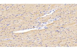 Detection of LOXL1 in Mouse Cardiac Muscle Tissue using Polyclonal Antibody to Lysyl Oxidase Like Protein 1 (LOXL1) (LOXL1 anticorps  (AA 392-598))