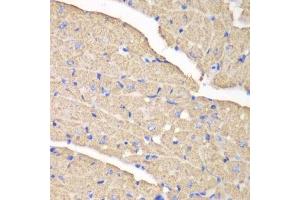 Immunohistochemistry of paraffin-embedded mouse heart using VDAC1 antibody. (VDAC1 anticorps  (AA 1-283))