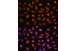 Immunofluorescence analysis of U2OS cells using CTBP2 Rabbit pAb (ABIN1679396, ABIN3015896, ABIN3015897 and ABIN6219473) at dilution of 1:100. (CTBP2 anticorps  (C-Term))