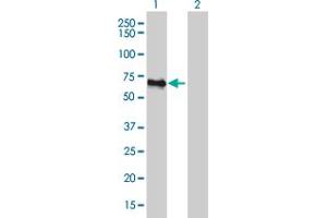 Western Blot analysis of FBLIM1 expression in transfected 293T cell line by FBLIM1 monoclonal antibody (M10), clone 5E11. (FBLIM1 anticorps  (AA 270-373))
