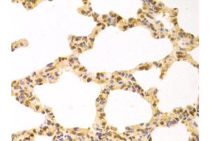 Immunohistochemistry of paraffin-embedded rat lung using STIP1 antibody at dilution of 1:100 (x400 lens). (STIP1 anticorps)