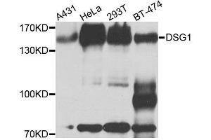 Western blot analysis of extracts of various cell lines, using DSG1 antibody. (Desmoglein 1 anticorps  (AA 800-1049))