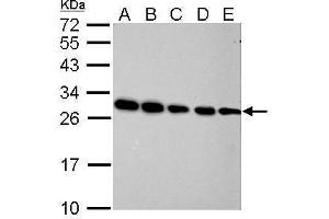 WB Image Prohibitin antibody detects PHB protein by Western blot analysis.