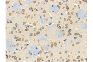ABIN6257892 and ABIN6274756 at 1/100 staining Mouse brain tissue by IHC-P. (RPS4X anticorps  (Internal Region))