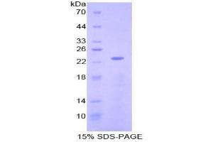 SDS-PAGE analysis of Mouse NME3 Protein. (NME3 Protéine)