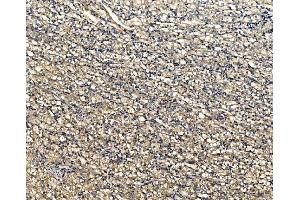 IHC analysis of ATG9A using anti-ATG9A antibody (ABIN7600676). (ATG9A anticorps  (AA 22-169))