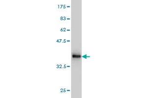 Western Blot detection against Immunogen (36. (NADSYN1 anticorps  (AA 609-706))