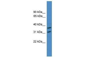Western Blot showing OTUD6A antibody used at a concentration of 1-2 ug/ml to detect its target protein.