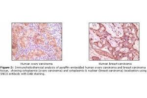 Image no. 1 for anti-Synuclein, gamma (Breast Cancer-Specific Protein 1) (SNCG) antibody (ABIN207620) (SNCG anticorps)