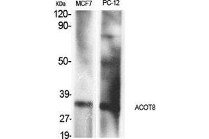 Western Blot (WB) analysis of specific cells using ACOT8 Polyclonal Antibody. (ACOT8 anticorps  (Internal Region))