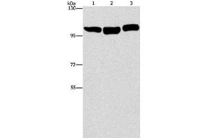 Western Blot analysis of Hela, NIH/3T3 and Raji cell using DNM2 Polyclonal Antibody at dilution of 1:400 (DNM2 anticorps)