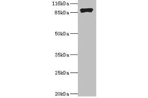 Western blot All lanes: RRM1 antibody at 2 μg/mL + Hela whole cell lysate Secondary Goat polyclonal to rabbit IgG at 1/10000 dilution Predicted band size: 91 kDa Observed band size: 91 kDa (RRM1 anticorps  (AA 1-792))