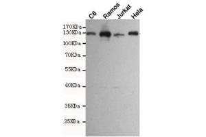 Western blot testing of rat C6 and human Ramos, Jurkat and HeLa cell lysates using JAK1 antibody at 1:1000. (JAK1 anticorps)