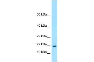 WB Suggested Anti-Rpl26 Antibody Titration: 1. (RPL26 anticorps  (Middle Region))
