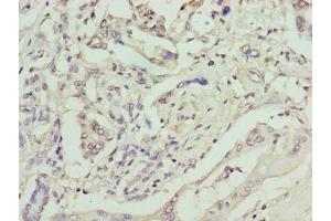 anti-Glycoprotein M6B (GPM6B) (AA 1-64) antibody