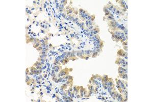 Immunohistochemistry of paraffin-embedded mouse lung using LRG1 antibody.