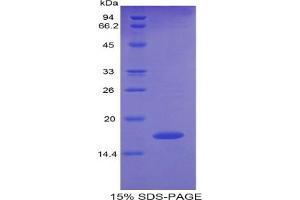 SDS-PAGE of Protein Standard from the Kit (Highly purified E. (Pleiotrophin Kit ELISA)