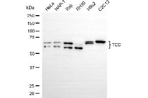 Western blotting analysis using TEC antibody (ABIN7799660).