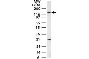 Western blot analysis of HDAC-4 in Jurkat cell lysate with HDAC4 polyclonal antibody  . (HDAC4 anticorps  (AA 194-209))