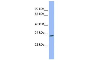 WB Suggested Anti-PENK Antibody Titration: 0. (Enkephalin anticorps  (Middle Region))