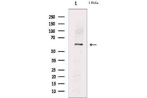 Western blot analysis of extracts from Hela cells, using PKM2(phospho-Ser37) Antibody. (PKM anticorps  (pSer37))