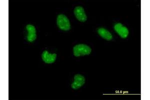 Immunofluorescence of purified MaxPab antibody to CUTC on HeLa cell. (CUTC anticorps  (AA 1-273))