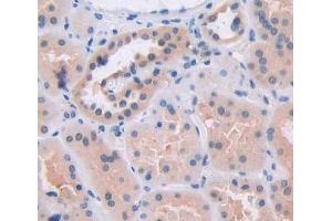 Used in DAB staining on fromalin fixed paraffin- embedded kidney tissue