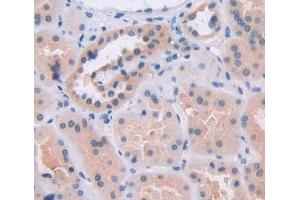 Used in DAB staining on fromalin fixed paraffin- embedded kidney tissue (BCAT2 anticorps  (AA 107-392))