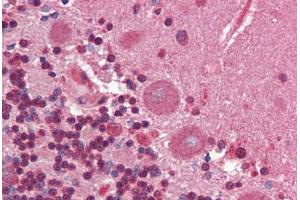 Human Brain, Cerebellum (formalin-fixed, paraffin-embedded) stained with Collagen I antibody ABIN462339 followed by biotinylated goat anti-rabbit IgG secondary antibody ABIN481713, alkaline phosphatase-streptavidin and chromogen. (Collagen Type I anticorps)