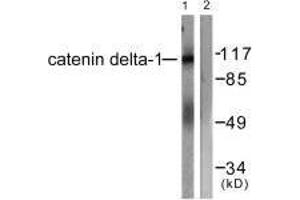 Western blot analysis of extracts from HuvEc cells, using Catenin-δ1 (Ab-228) antibody. (CTNND1 anticorps  (Tyr228))
