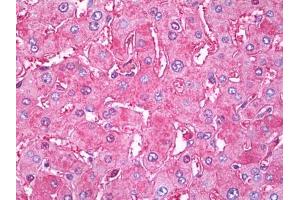 Image no. 1 for anti-Transferrin (TF) antibody (ABIN471288) (Transferrin anticorps)