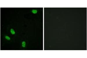 Immunofluorescence analysis of HeLa cells, using Progesterone Receptor (Phospho-Ser294) Antibody.