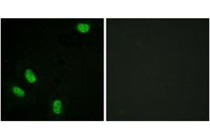 Immunofluorescence analysis of HeLa cells, using Progesterone Receptor (Phospho-Ser294) Antibody. (Progesterone Receptor anticorps  (pSer294))