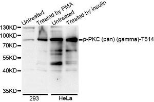 Western blot analysis of extracts of various cell lines, using Phospho-PKC (pan) (gamma)-T514 antibody. (PRKCA beta 2 anticorps  (pThr497))