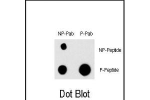 Dot blot analysis of Phospho-EGFR- Antibody (ABIN1881284 and ABIN2850455) and EGFR Non Phospho-specific Pab on nitrocellulose membrane.
