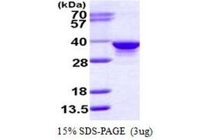 SDS-PAGE (SDS) image for Ribose 5-Phosphate Isomerase A (RPIA) (AA 1-311) protein (His tag) (ABIN667643) (Ribose 5-Phosphate Isomerase A (RPIA) (AA 1-311) protein (His tag))