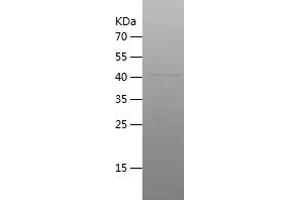 Western Blotting (WB) image for Jun B Proto-Oncogene (JUNB) (AA 1-200) protein (His-IF2DI Tag) (ABIN7123650)