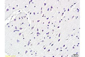 Formalin-fixed and paraffin embedded rat brain labeled with Anti KCNN4 Polyclonal Antibody, Unconjugated (ABIN719786) at 1:200 followed by conjugation to the secondary antibody and DAB staining (KCNN4 anticorps  (AA 325-427))