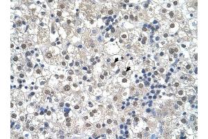 RTN2 antibody was used for immunohistochemistry at a concentration of 4-8 ug/ml to stain Hepatocytes (arrows) in Human Liver. (Reticulon 2 anticorps  (N-Term))
