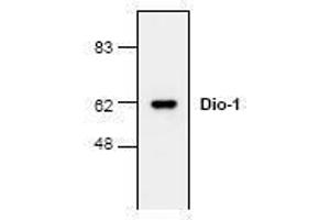 Image no. 1 for anti-Death Inducer-Obliterator 1 (DIDO1) (N-Term) antibody (ABIN127222) (DIDO1 anticorps  (N-Term))