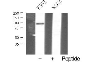 Western blot analysis of VAV1 expression in K562 whole cell lysates,The lane on the left is treated with the antigen-specific peptide. (VAV1 anticorps  (N-Term))