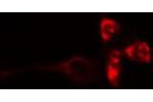 ABIN6272379 staining COLO205 by IF/ICC. (OTUB2 anticorps  (Internal Region))