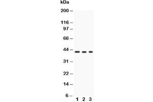 Western blot testing of GAP43 antibody and Lane 1:  U87 (GAP43 anticorps)